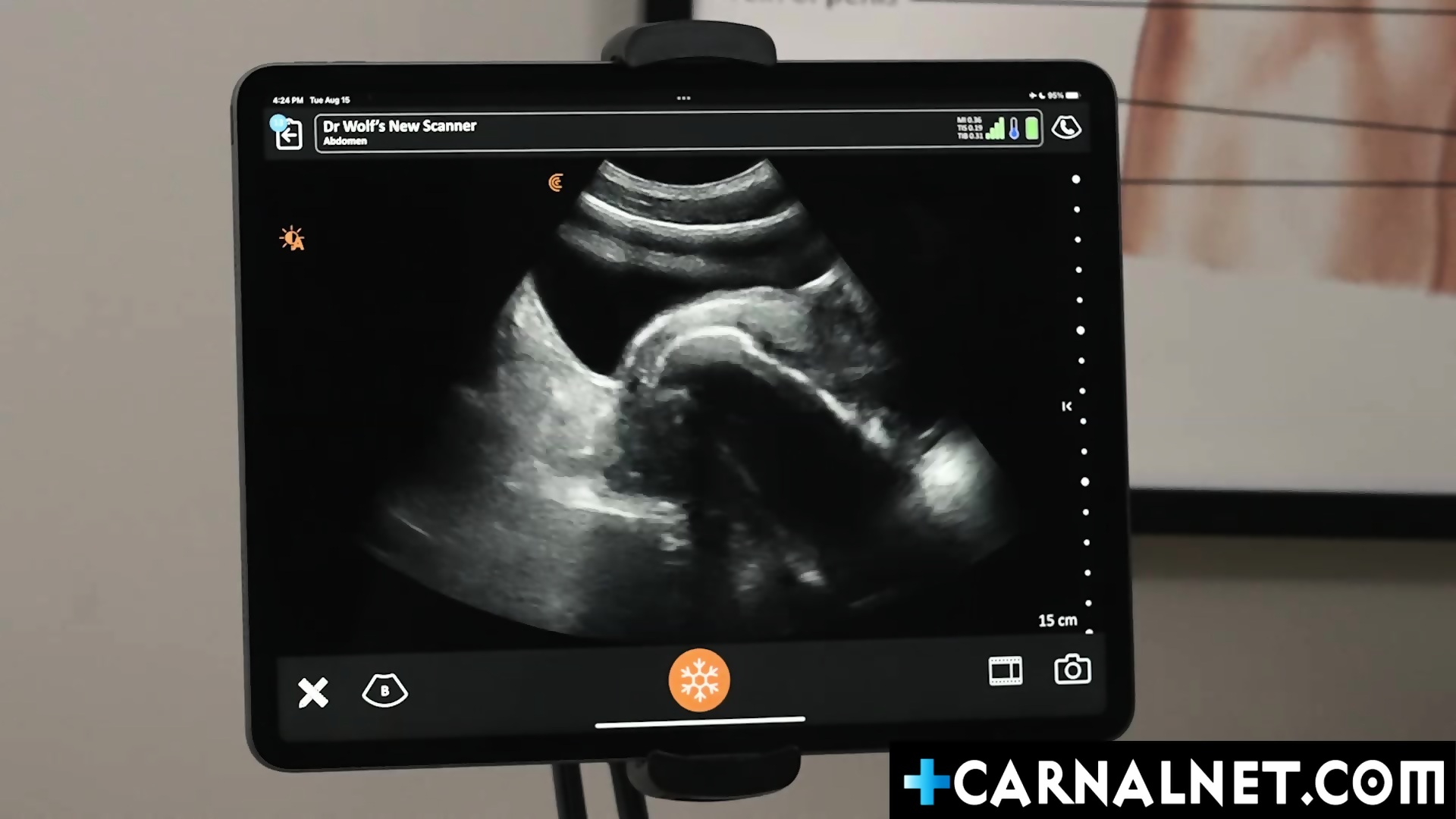 aimee potts add legrand wolf ultrasound image