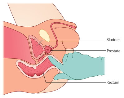 adeolu adeyemi add cum during prostate exam image