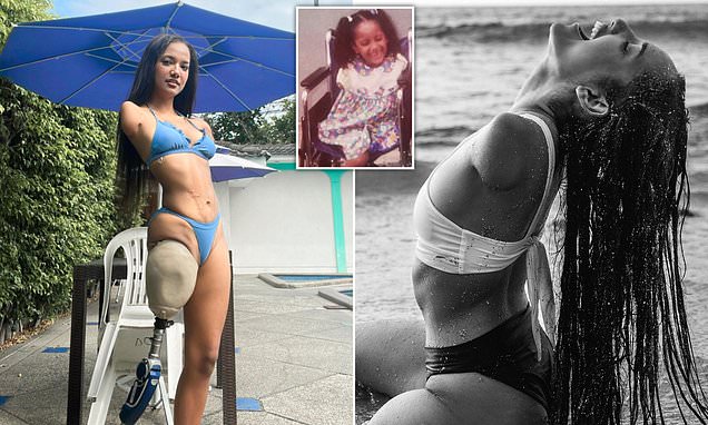 calvin alonzo add amputee in bikini photo