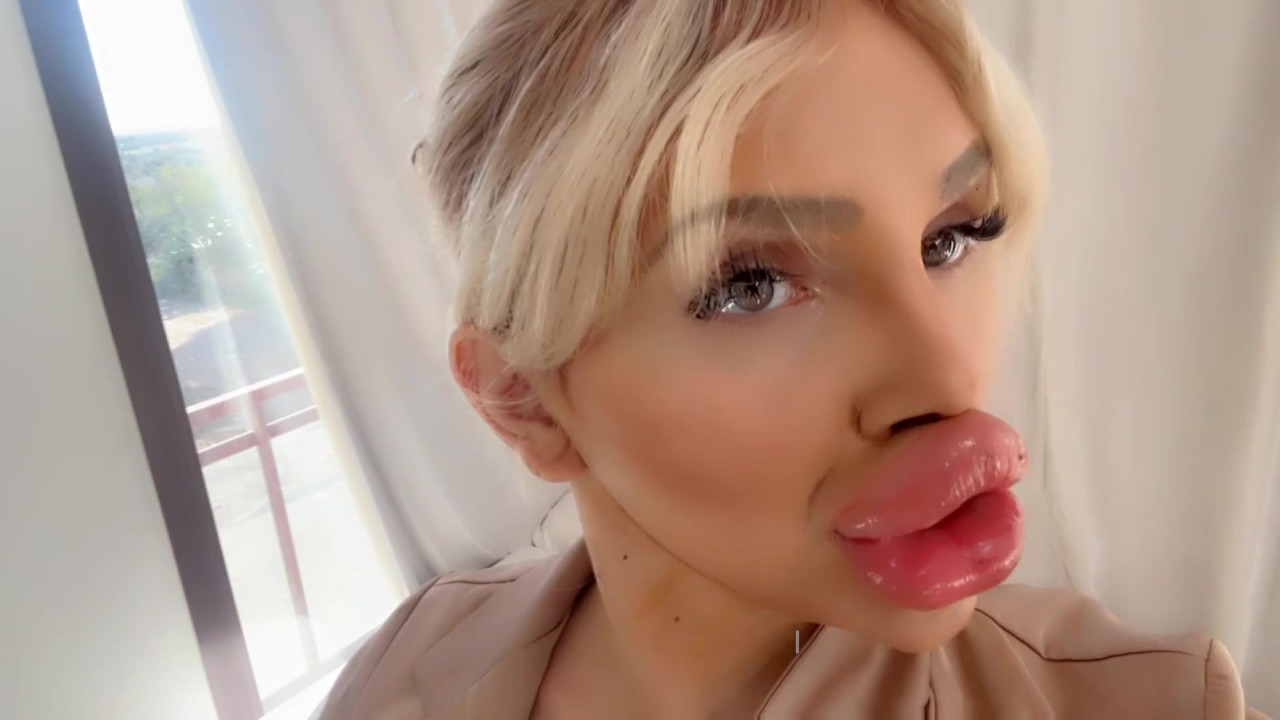 cassie macrae add big lips porn photo