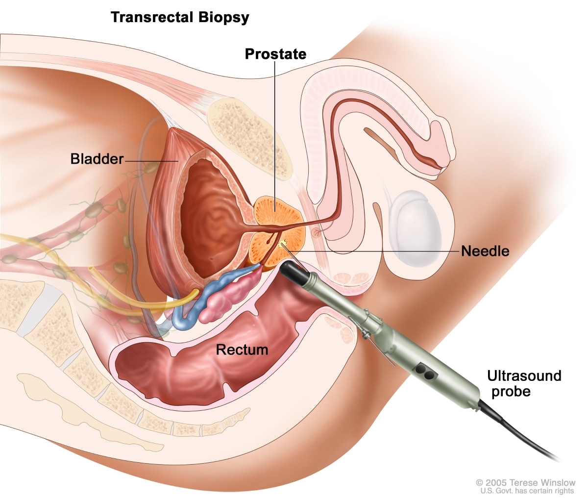 arwin canlas add cum during prostate exam image