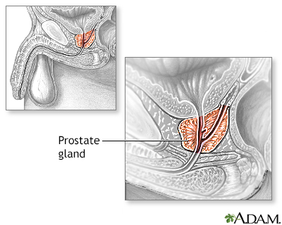 abiodun teslim add cum during prostate exam image