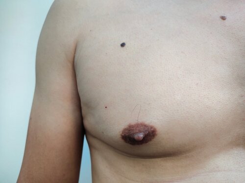 donald werner add super puffy nipple image