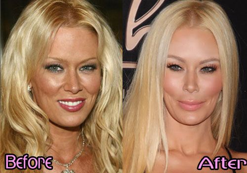 cynthia briggs add jenna jameson facial photo