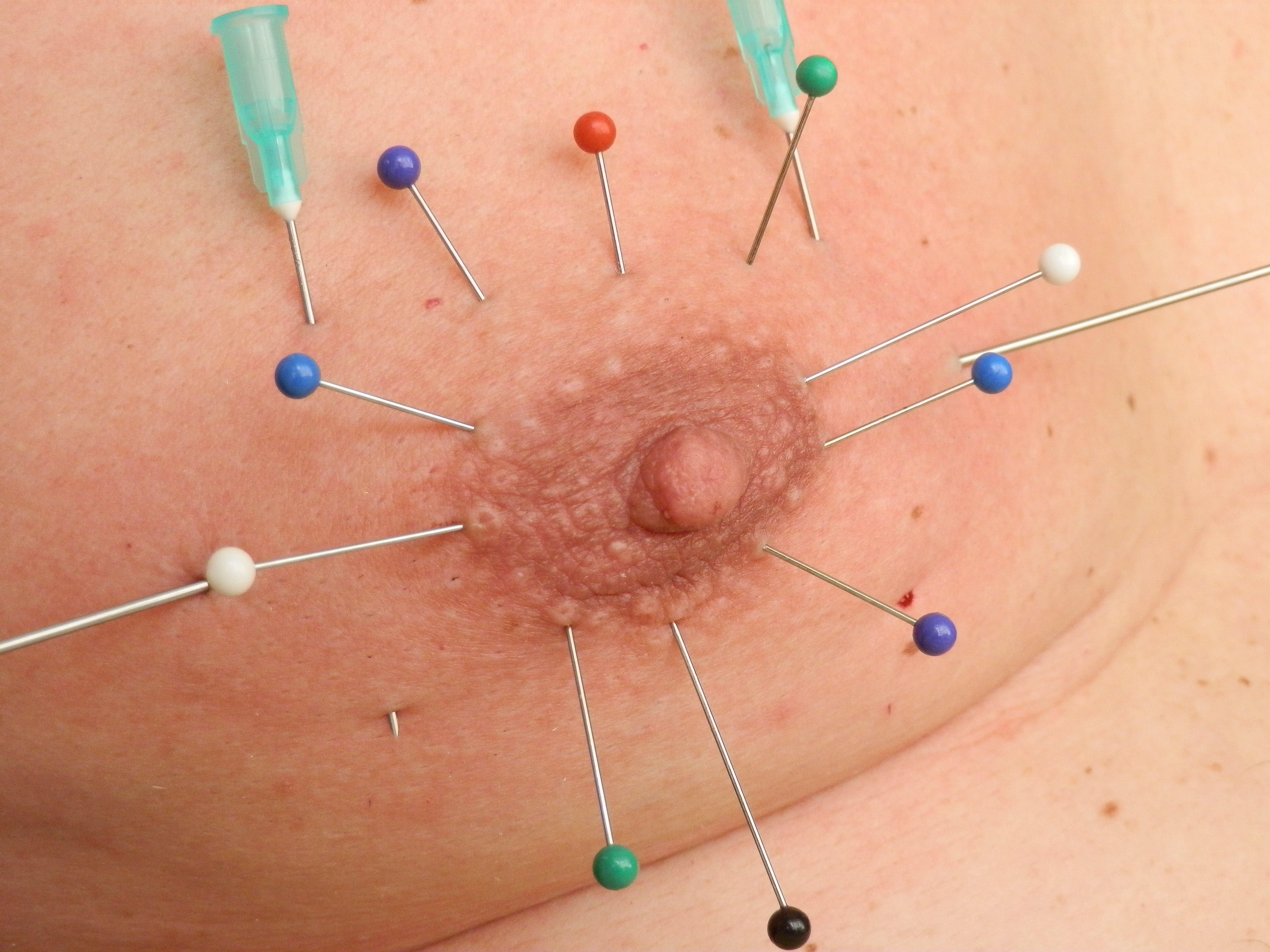 colleen crow add nipple needle torture photo