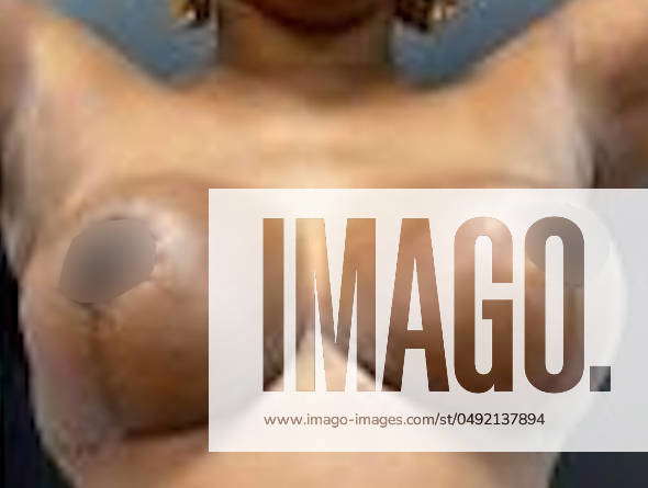 black dollar add tortured breasts image